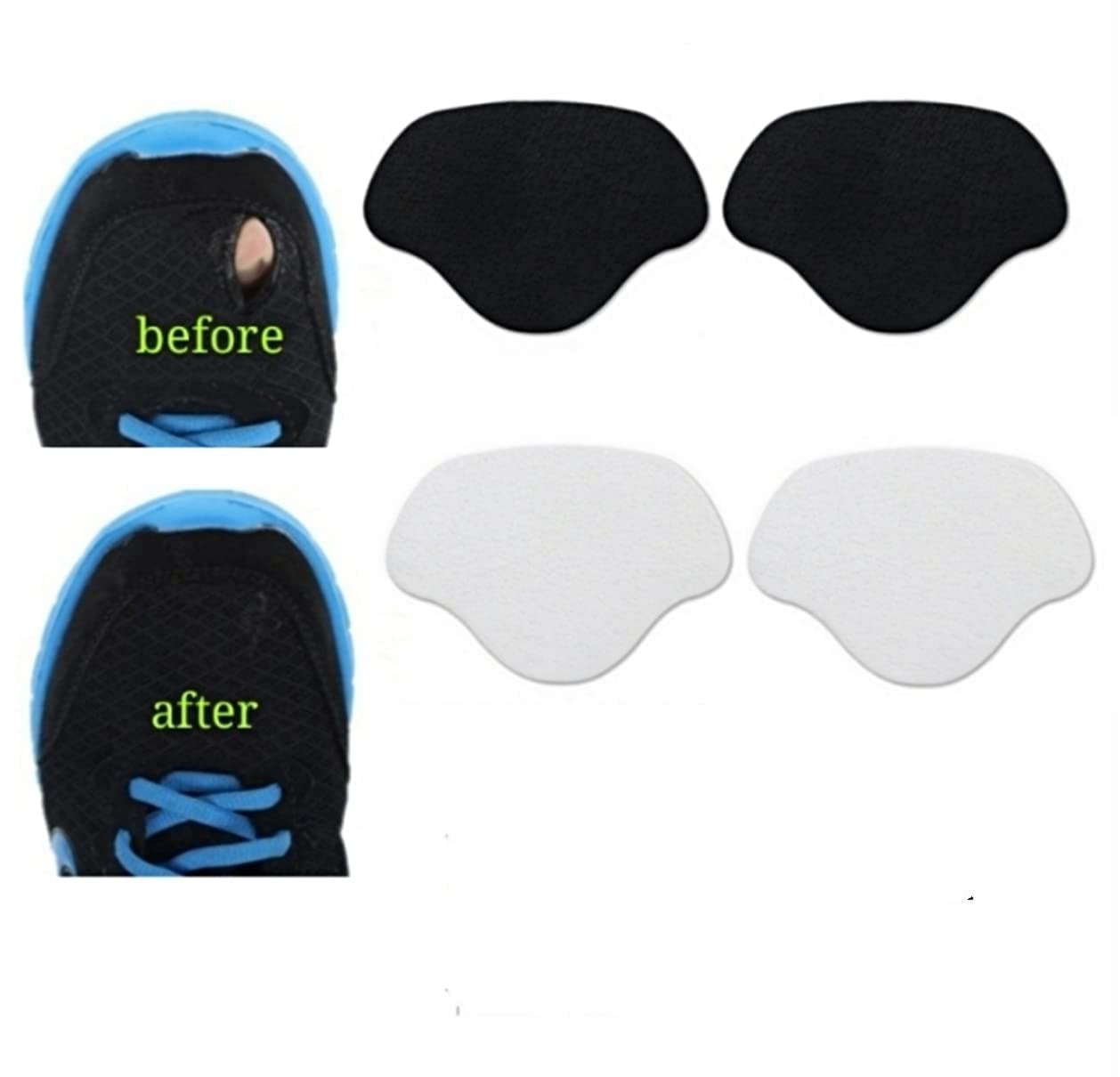 Heng happy Sneaker Toe/Heel Prevention Repair, Shoe Hole Toeburst Patch/Insert, Wear Self-adhesive, 1pairs of Black and 1 pair of White