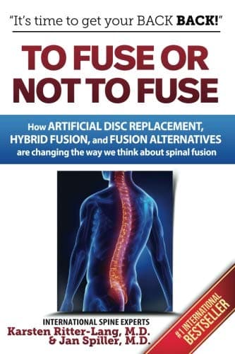 To Fuse or Not to Fuse: How Artificial Disc Replacement, Hybrid Fusion, and Fusion Alternatives are Changing the Way We Think about Spinal Fusion