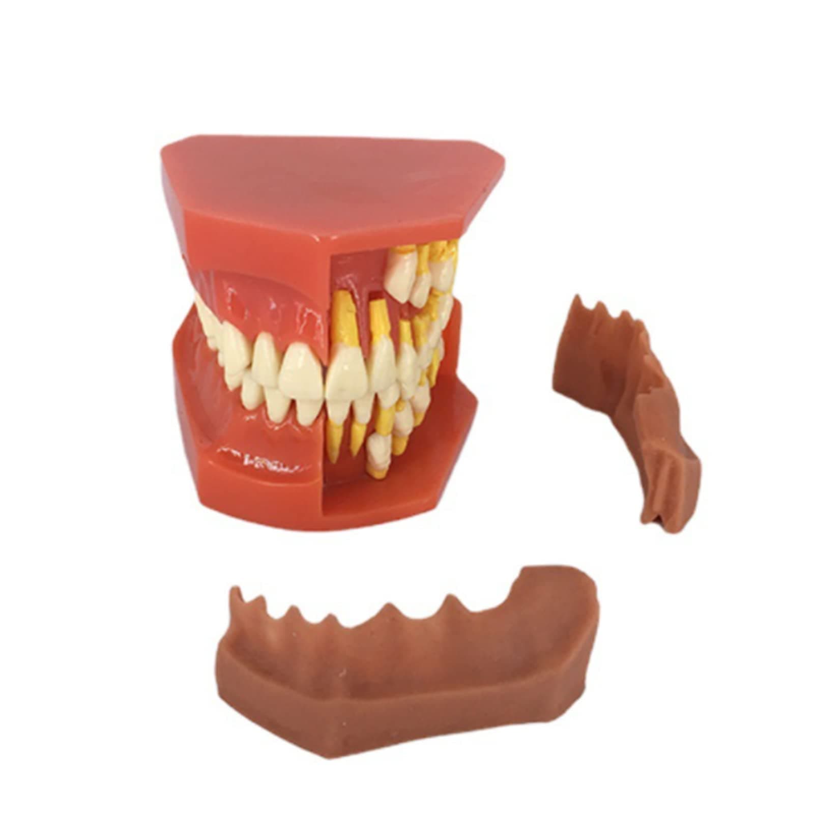 Milk Teeth Model, Detachable Teeth Eruption Development Model, Alternate Display Model of Oral Primary and Permanent Teeth for Doctor Patient Communication Model Teach Demo