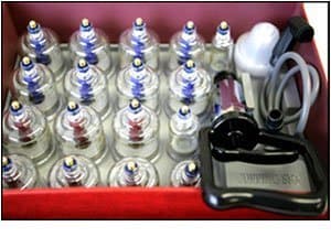 Cupping Therapy 2-in-1 Acupuncture Magnetic Therapy