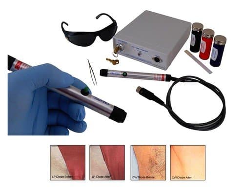 Schönheitssalon Permanent Laser Haarentfernung System mit Behandlungskit