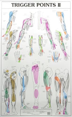 Trigger Points I and II Laminated Chart/Posters