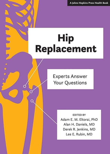 Hip Replacement: Experts Answer Your Questions (A Johns Hopkins Press Health Book)