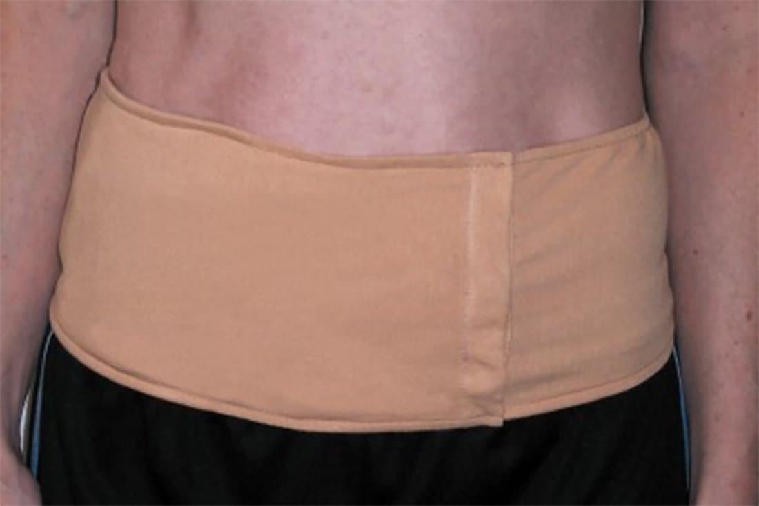 Phoenix Ostomy Belt Extra-large/2Extra-large, 36" to 47" Waist (1 Each)