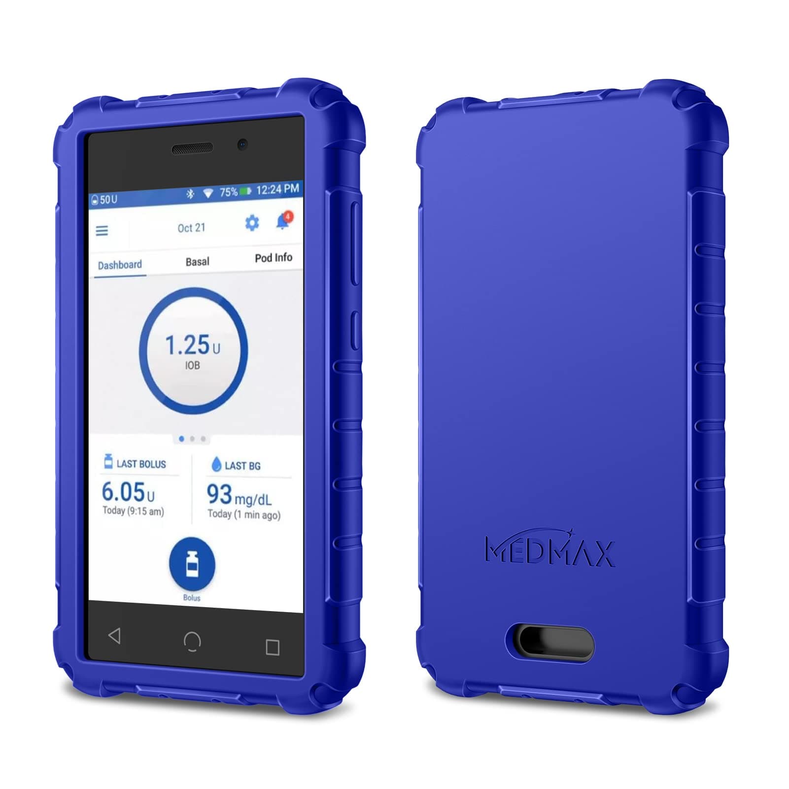 シリコンケース Omnipod Dash PDM(パーソナル糖尿病マネージャー)用 軽量 耐衝撃 滑り止め 保護カバー ソフトジェルスキン 隆起したベゼル付き Omnipod Dashデバイス用 (ネイビー)