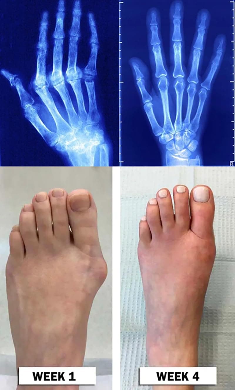 Beevana Bee Venom Joint and Bone Therapy Cream,30g Bee Venom Joint and Bone Relief Cream,Joint & Bone Therapy Cream,Full Body Recovery (1pcs)