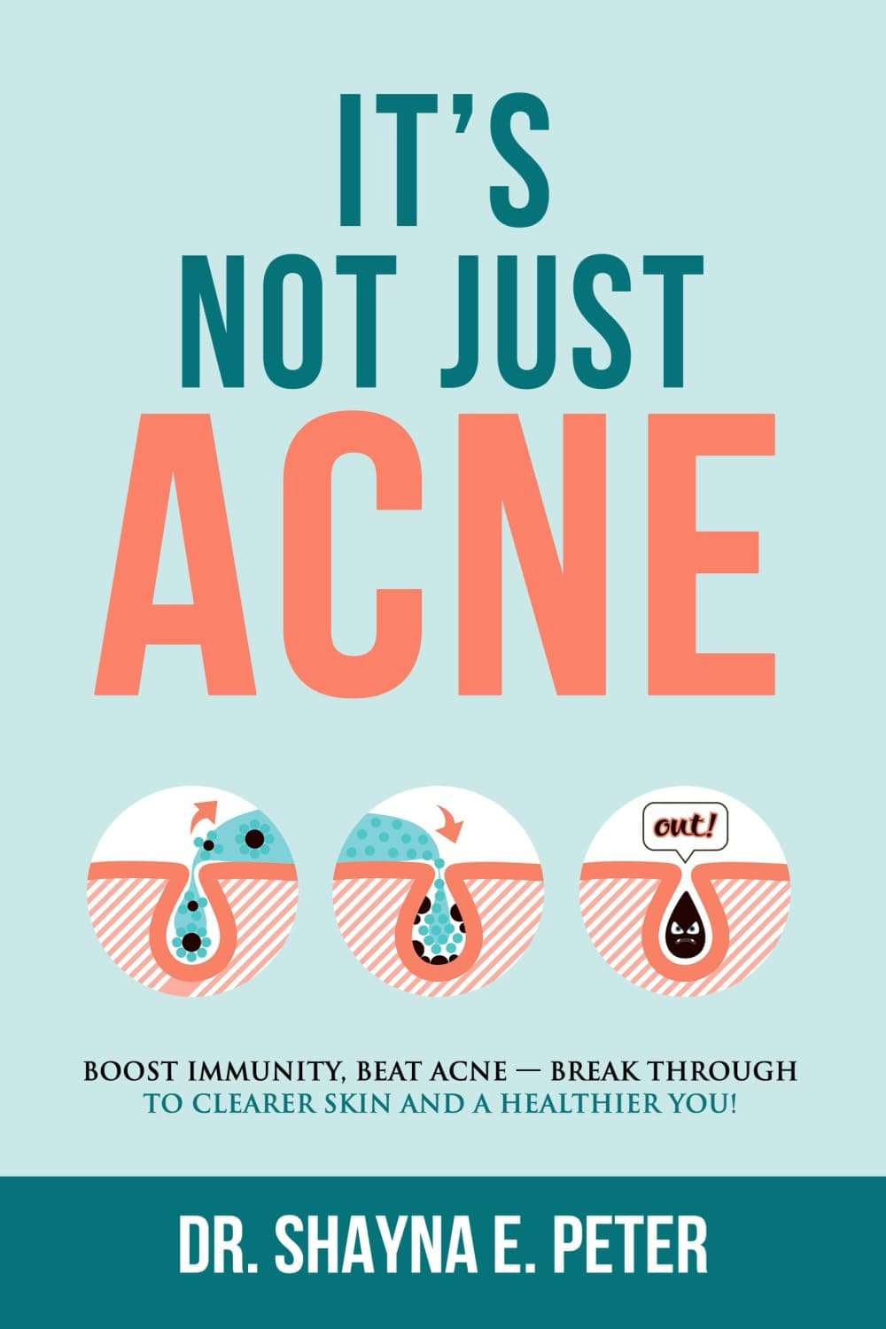It's Not Just Acne: Boost Immunity, Beat Acne - Break Through to Clear