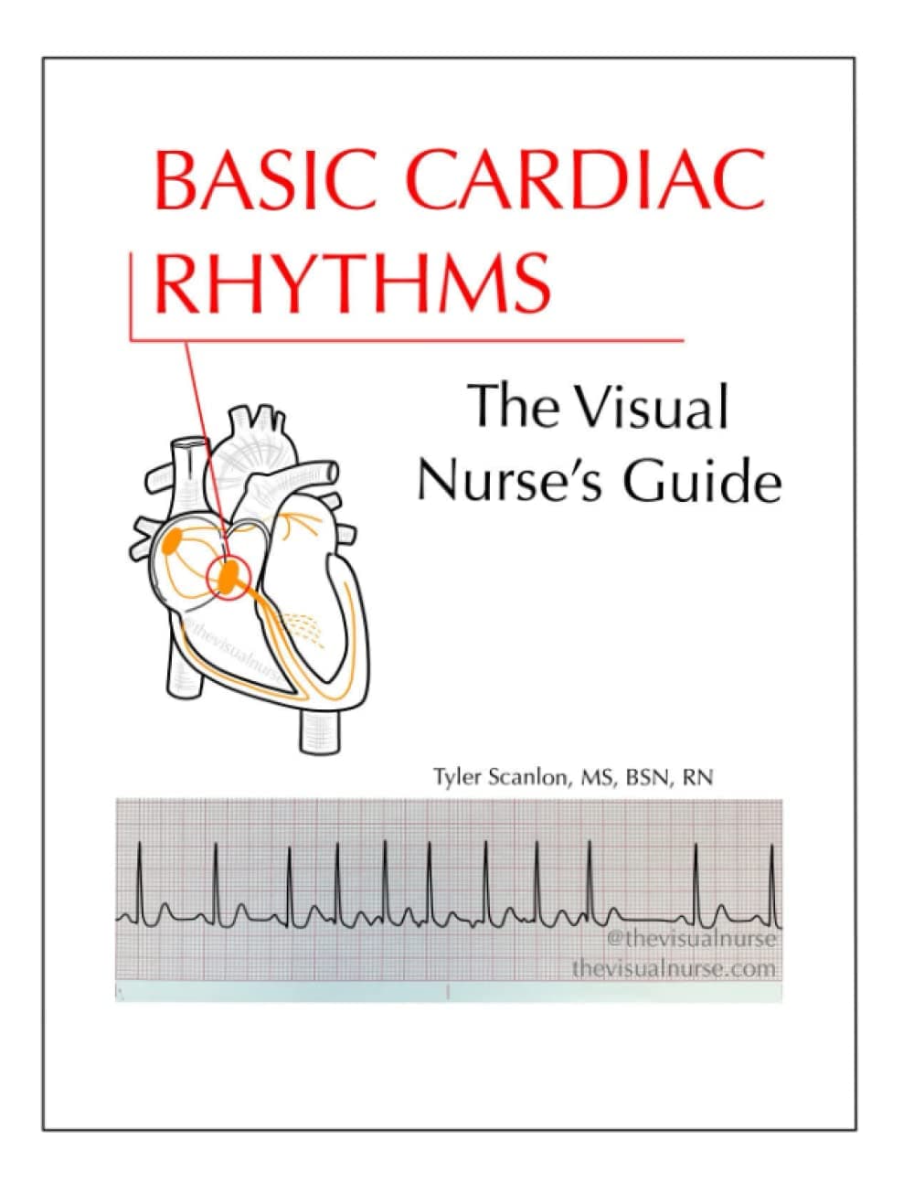 Independently published Basic Cardiac Rhythms: The Visual Nurse's Guide (The Visual Nurse's Basic ECG Series)
