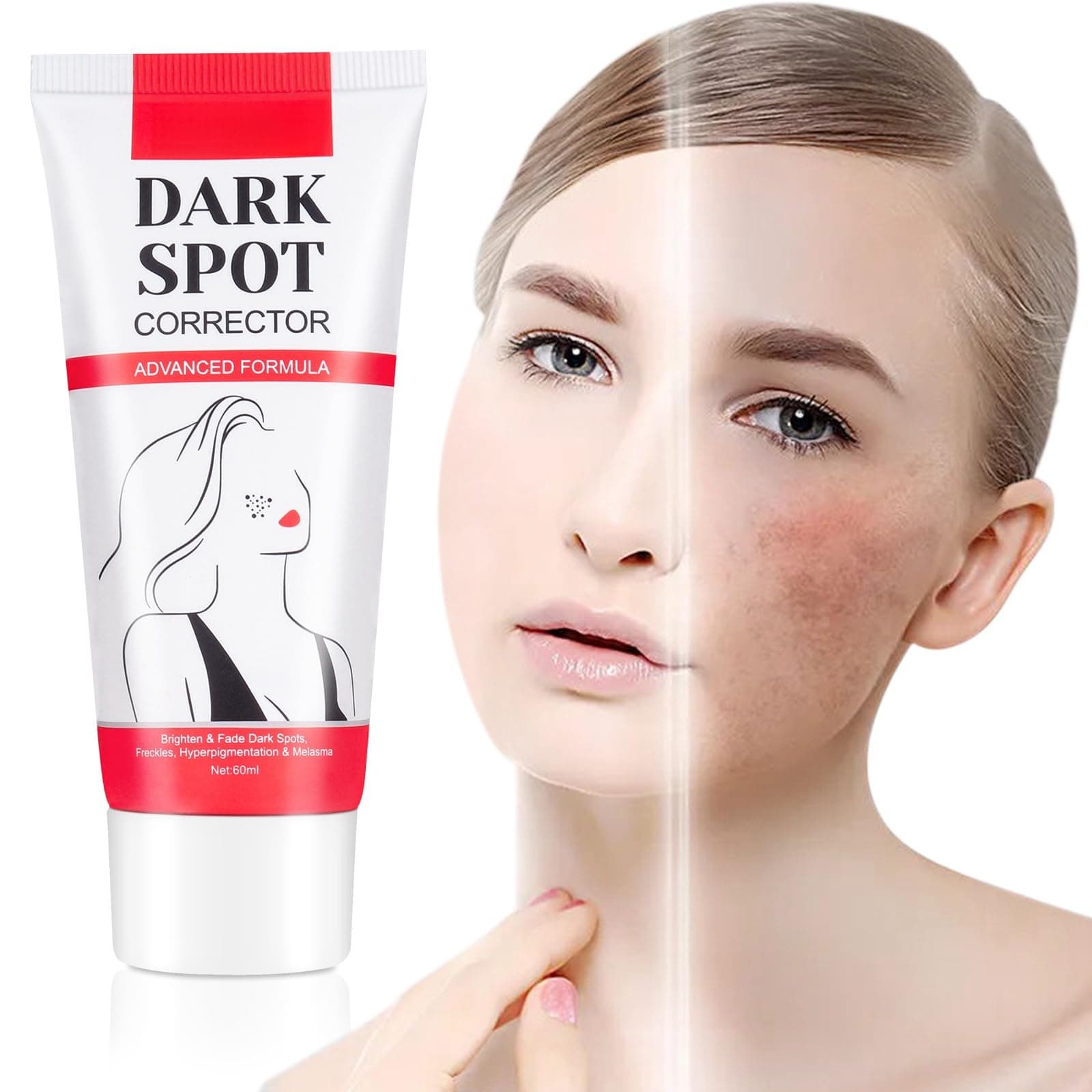 JDLYEVER Dark Spot Corrector 60ml Advanced Dark Spot Reduction Intensive Hydration Skin Repair Non-Greasy Formula Rapid Results, Natural Moisture Balance and Promote A Smoother, More Supple Complexion