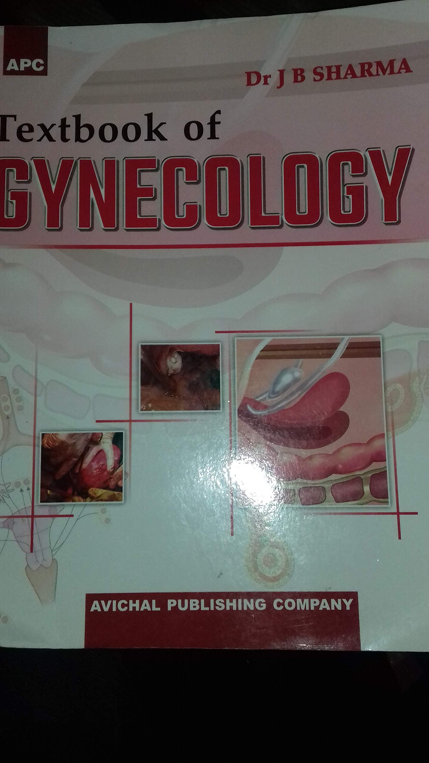 Textbook Of Gynecology