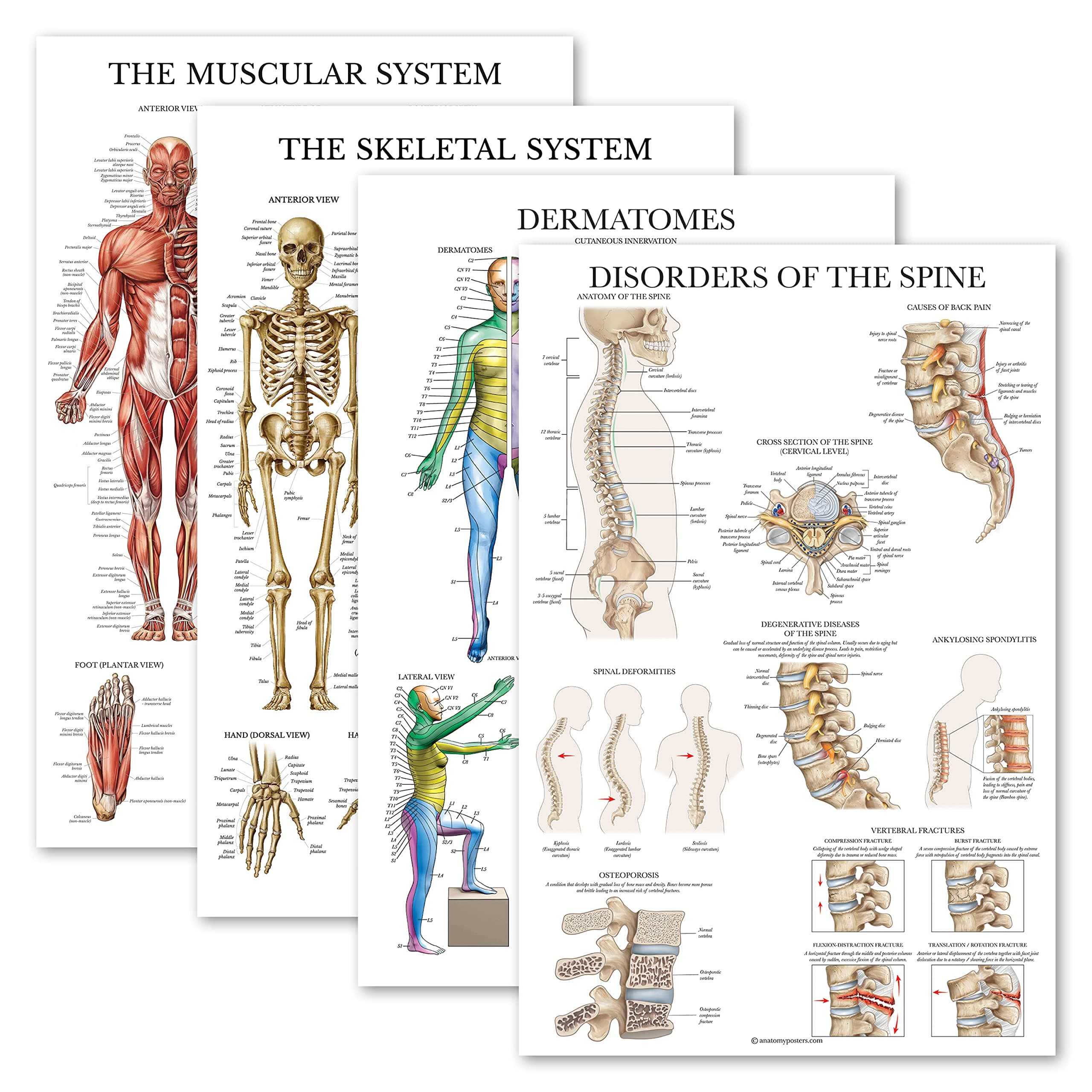 Palace Learning 4 Pack - Anatomical Poster Set - Laminated - Muscular, Skeletal, Dermatomes, Disorders of the Spine - Anatomy Chart Set (LAMINATED, 18'' x 27'')